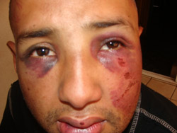 Honduras : Dernières exactions constatées au 4 mars