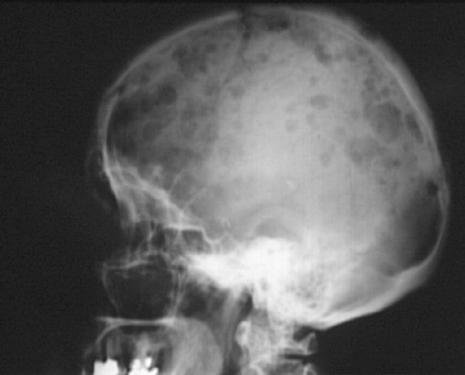 Primitivi au Festival paroles de Galère